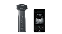Wireless Ultrasound Diagnostic Imaging Device Wireless Ultrasound Diagnostic Imaging Device